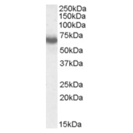 Western Blot - Anti-Ikaros Antibody (A83470) - Antibodies.com