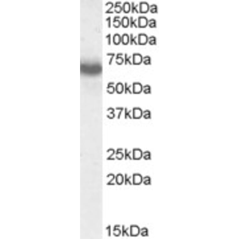 Western Blot - Anti-Ikaros Antibody (A83470) - Antibodies.com