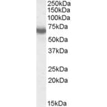 Western Blot - Anti-Ikaros Antibody (A83470) - Antibodies.com