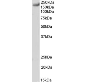 Western Blot - Anti-CACNA1C Antibody (A83471) - Antibodies.com