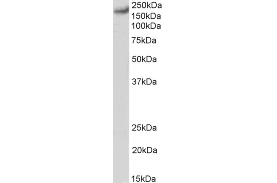 Western Blot - Anti-CACNA1C Antibody (A83471) - Antibodies.com