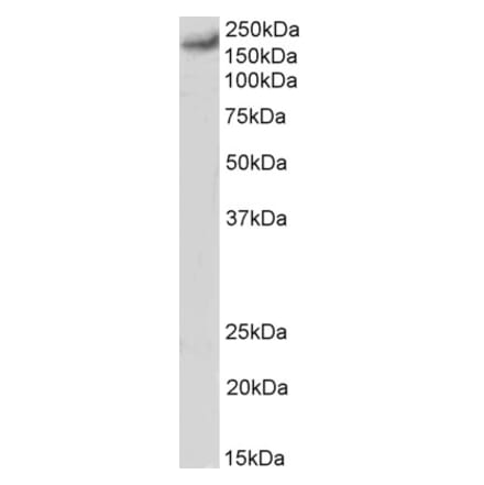 Western Blot - Anti-CACNA1C Antibody (A83471) - Antibodies.com