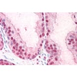 Immunohistochemistry - Anti-PUF60/FIR Antibody (A83473) - Antibodies.com