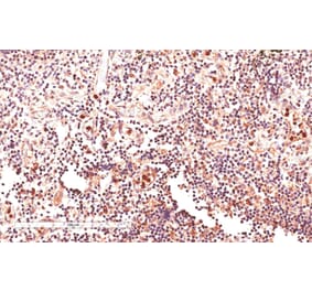 Immunohistochemistry - Anti-GLI2 Antibody (A83474) - Antibodies.com