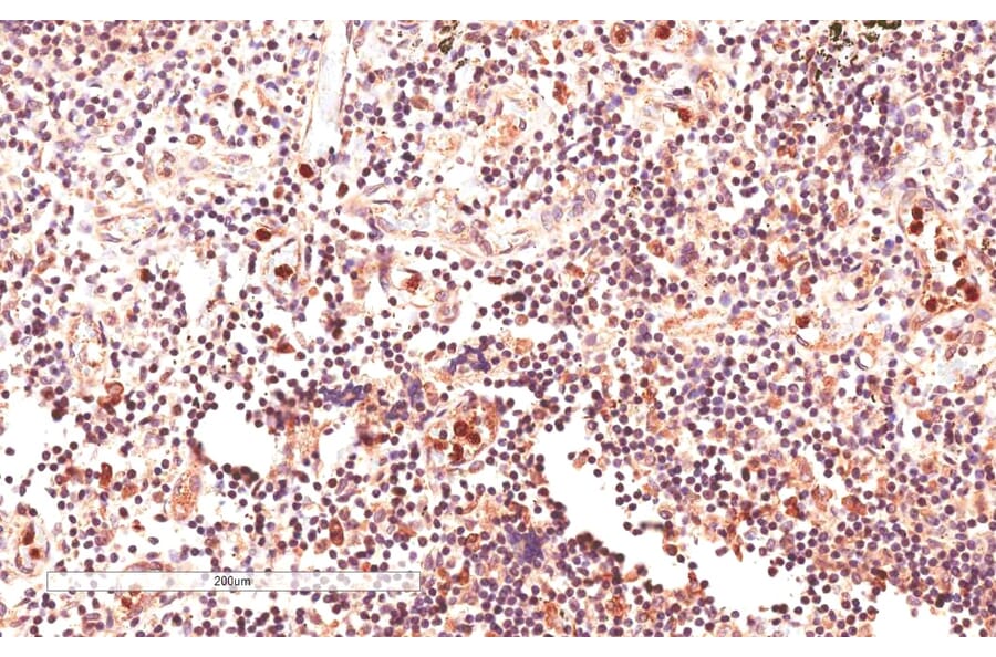 Immunohistochemistry - Anti-GLI2 Antibody (A83474) - Antibodies.com