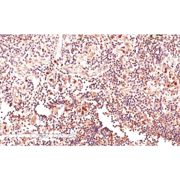 Immunohistochemistry - Anti-GLI2 Antibody (A83474) - Antibodies.com