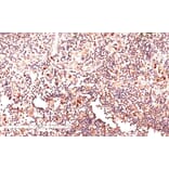 Immunohistochemistry - Anti-GLI2 Antibody (A83474) - Antibodies.com