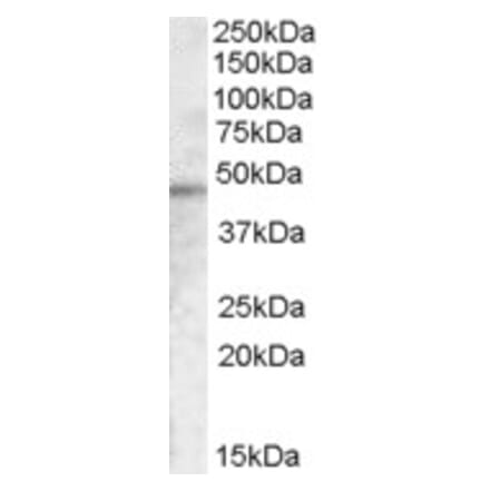 Western Blot - Anti-TMPRSS3 Antibody (A83475) - Antibodies.com