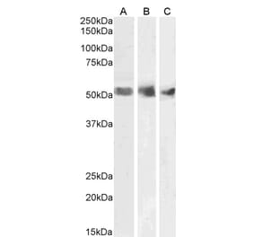 Western Blot - Anti-Wilms Tumor Protein Antibody (A83477) - Antibodies.com