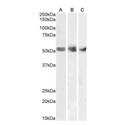 Western Blot - Anti-Wilms Tumor Protein Antibody (A83477) - Antibodies.com