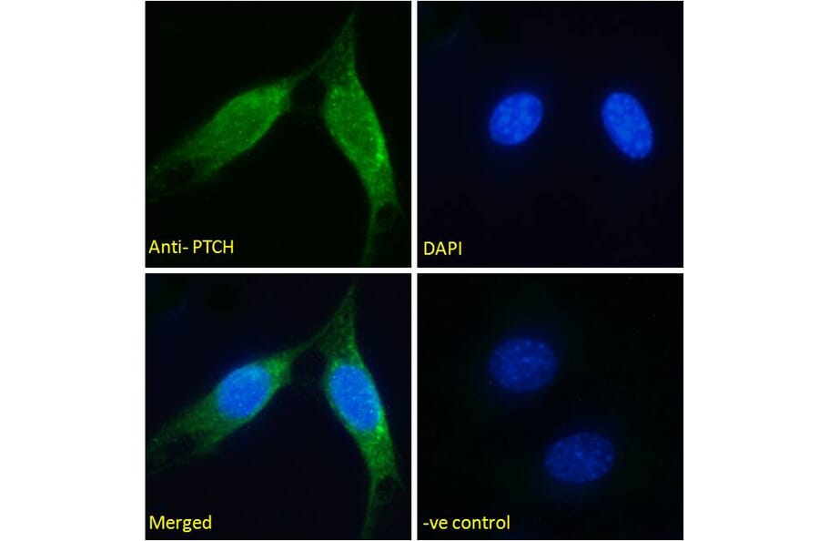 Immunofluorescence - Anti-Patched/PTCH1 Antibody (A83478) - Antibodies.com