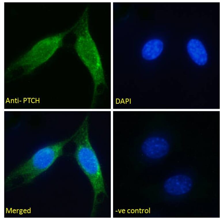 Immunofluorescence - Anti-Patched/PTCH1 Antibody (A83478) - Antibodies.com