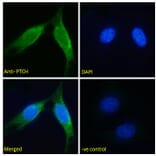 Immunofluorescence - Anti-Patched/PTCH1 Antibody (A83478) - Antibodies.com