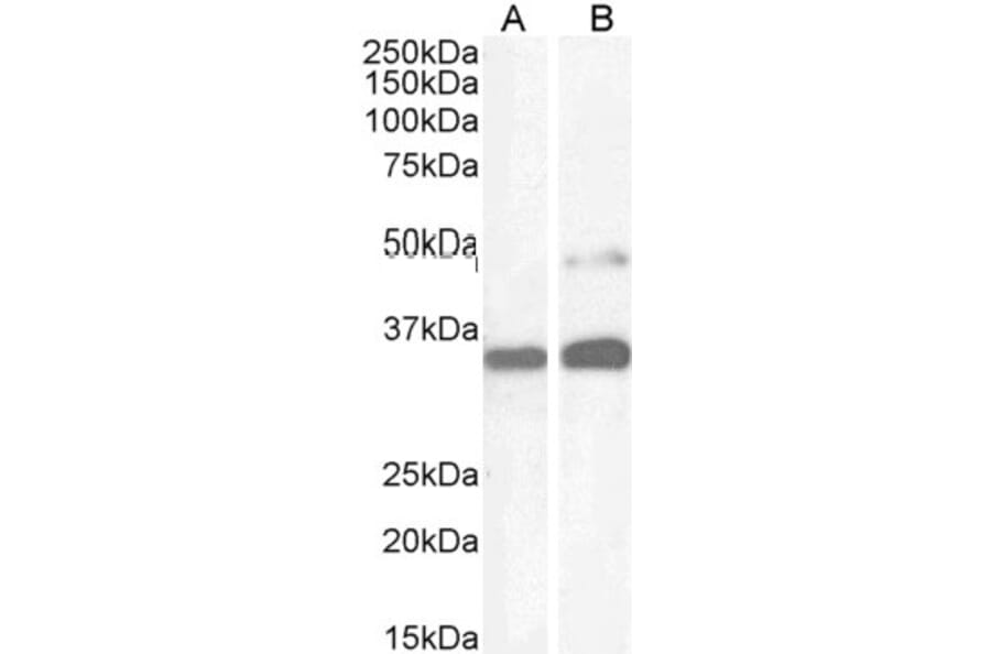 Western Blot - Anti-PAX8 Antibody (A83481) - Antibodies.com