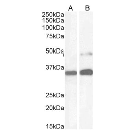 Western Blot - Anti-PAX8 Antibody (A83481) - Antibodies.com
