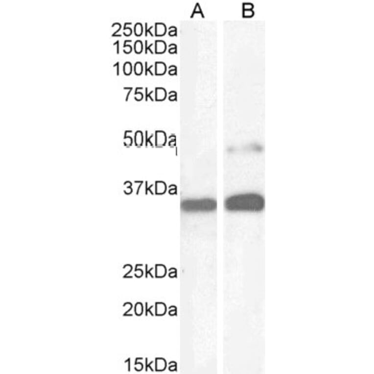 Western Blot - Anti-PAX8 Antibody (A83481) - Antibodies.com