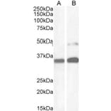 Western Blot - Anti-PAX8 Antibody (A83481) - Antibodies.com