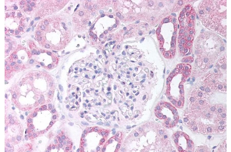 Immunohistochemistry - Anti-PAX8 Antibody (A83481) - Antibodies.com