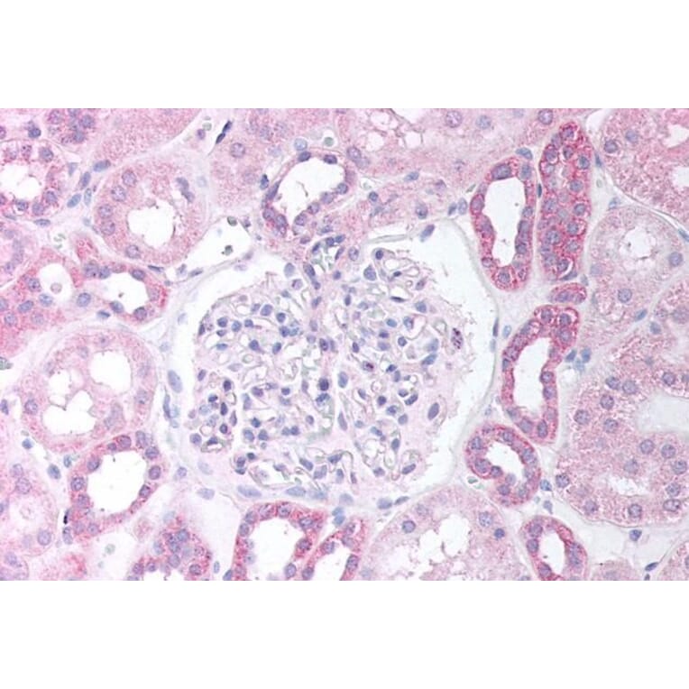 Immunohistochemistry - Anti-PAX8 Antibody (A83481) - Antibodies.com