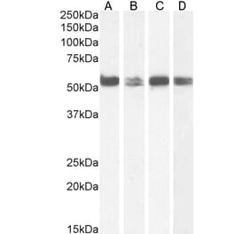 Western Blot - Anti-PTBP1 Antibody (A83482) - Antibodies.com