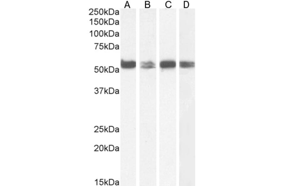 Western Blot - Anti-PTBP1 Antibody (A83482) - Antibodies.com