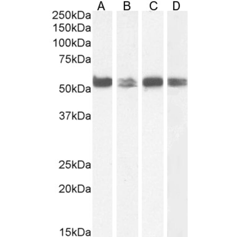 Western Blot - Anti-PTBP1 Antibody (A83482) - Antibodies.com
