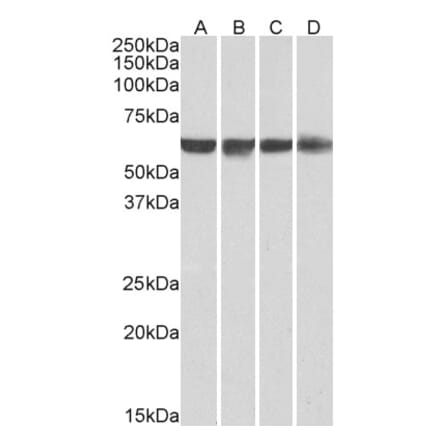Western Blot - Anti-PTBP1 Antibody (A83482) - Antibodies.com