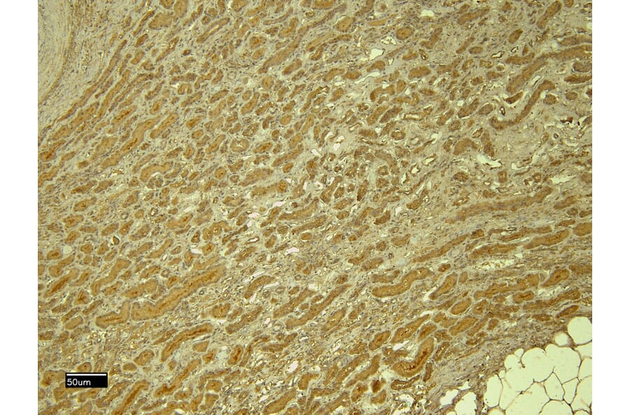 Immunohistochemistry - Anti-PTBP1 Antibody (A83482) - Antibodies.com