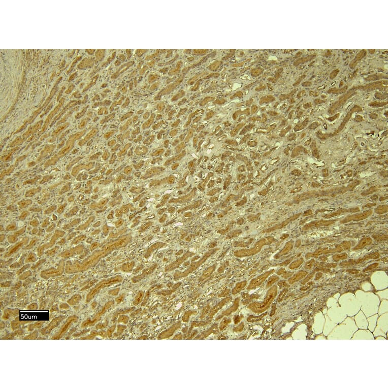 Immunohistochemistry - Anti-PTBP1 Antibody (A83482) - Antibodies.com
