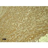 Immunohistochemistry - Anti-PTBP1 Antibody (A83482) - Antibodies.com