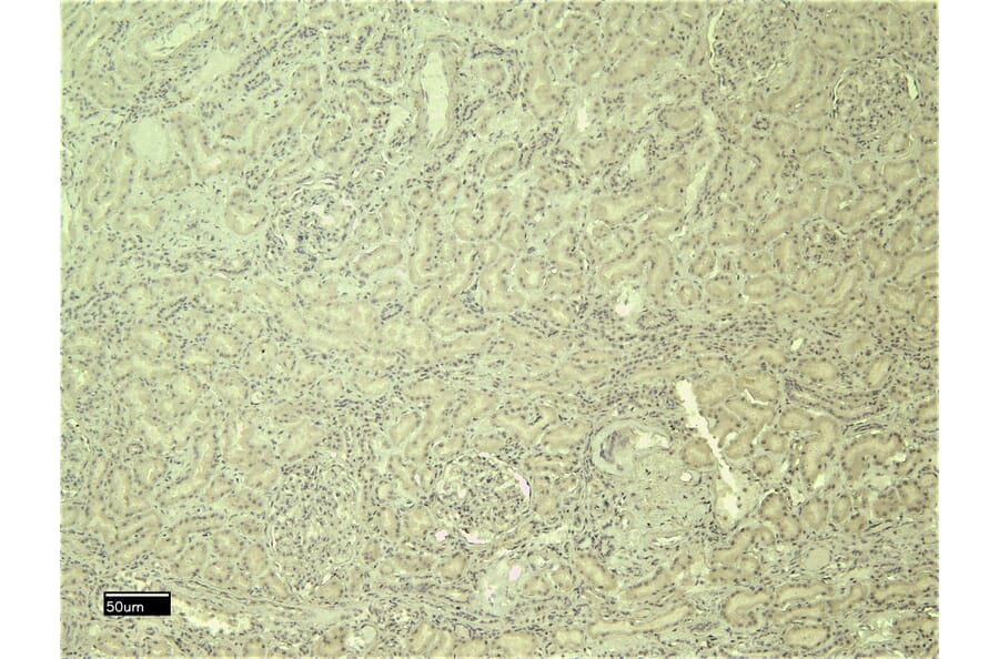 Immunohistochemistry - Anti-PTBP1 Antibody (A83482) - Antibodies.com