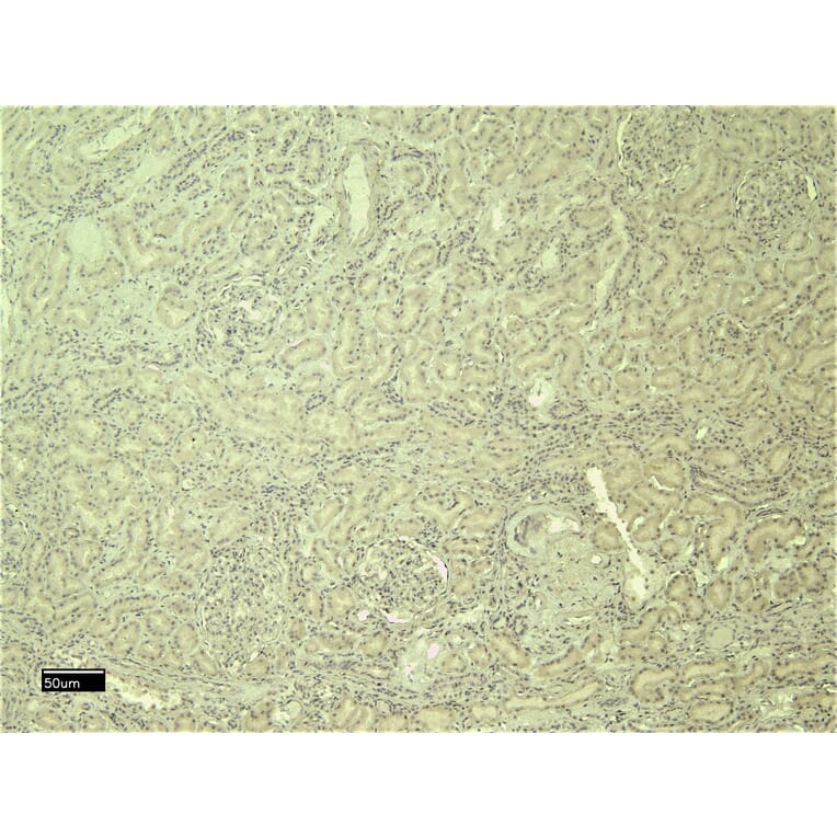 Immunohistochemistry - Anti-PTBP1 Antibody (A83482) - Antibodies.com