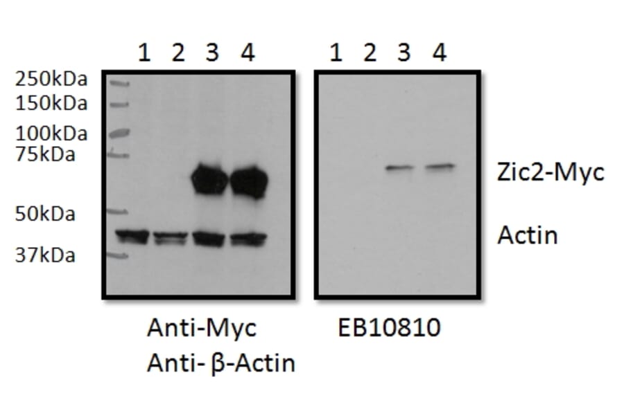 Western Blot - Anti-ZIC2 Antibody (A83484) - Antibodies.com