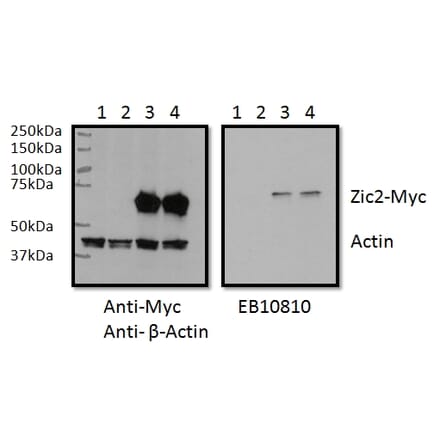 Western Blot - Anti-ZIC2 Antibody (A83484) - Antibodies.com