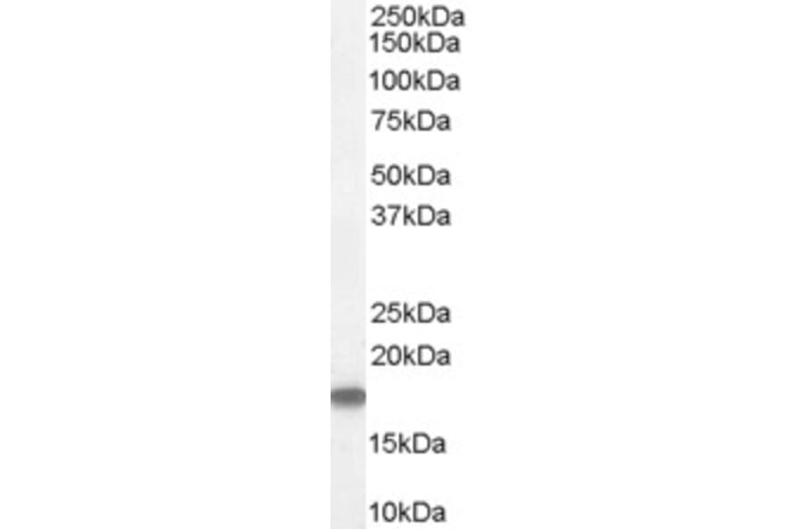 Western Blot - Anti-Stathmin 1 Antibody (A83488) - Antibodies.com