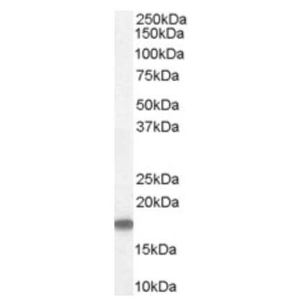 Western Blot - Anti-Stathmin 1 Antibody (A83488) - Antibodies.com