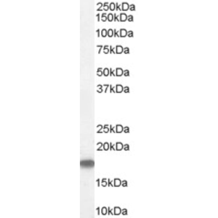 Western Blot - Anti-Stathmin 1 Antibody (A83488) - Antibodies.com