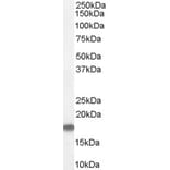 Western Blot - Anti-Stathmin 1 Antibody (A83488) - Antibodies.com