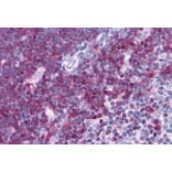 Immunohistochemistry - Anti-Stathmin 1 Antibody (A83488) - Antibodies.com