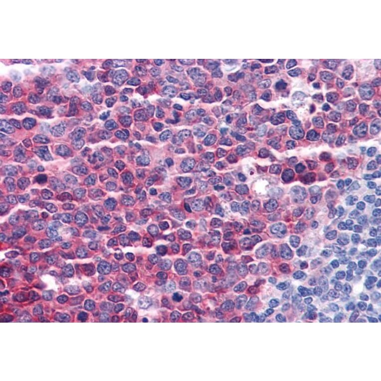 Immunohistochemistry - Anti-Stathmin 1 Antibody (A83488) - Antibodies.com