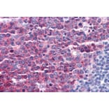 Immunohistochemistry - Anti-Stathmin 1 Antibody (A83488) - Antibodies.com