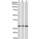 Western Blot - Anti-CAPZB Antibody (A83489) - Antibodies.com