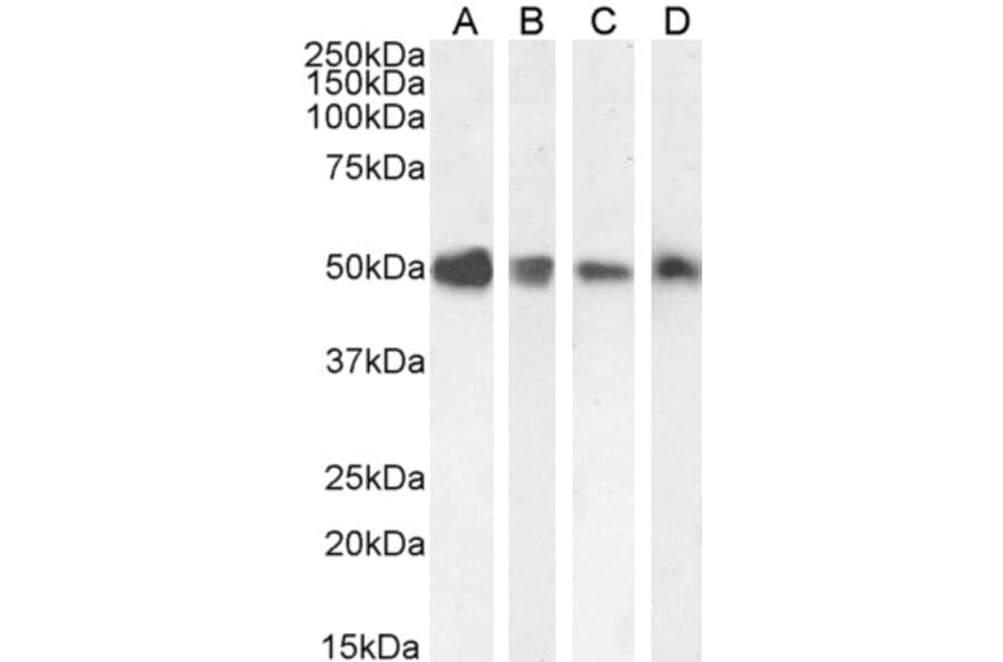 Western Blot - Anti-TXNDC5 Antibody (A83490) - Antibodies.com