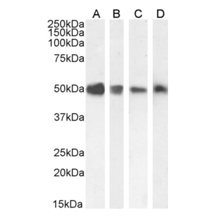 Western Blot - Anti-TXNDC5 Antibody (A83490) - Antibodies.com