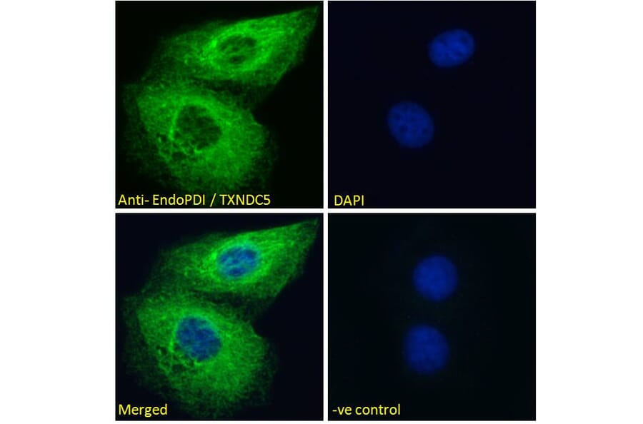 Immunofluorescence - Anti-TXNDC5 Antibody (A83490) - Antibodies.com