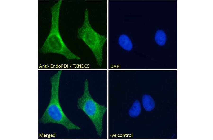 Immunofluorescence - Anti-TXNDC5 Antibody (A83490) - Antibodies.com