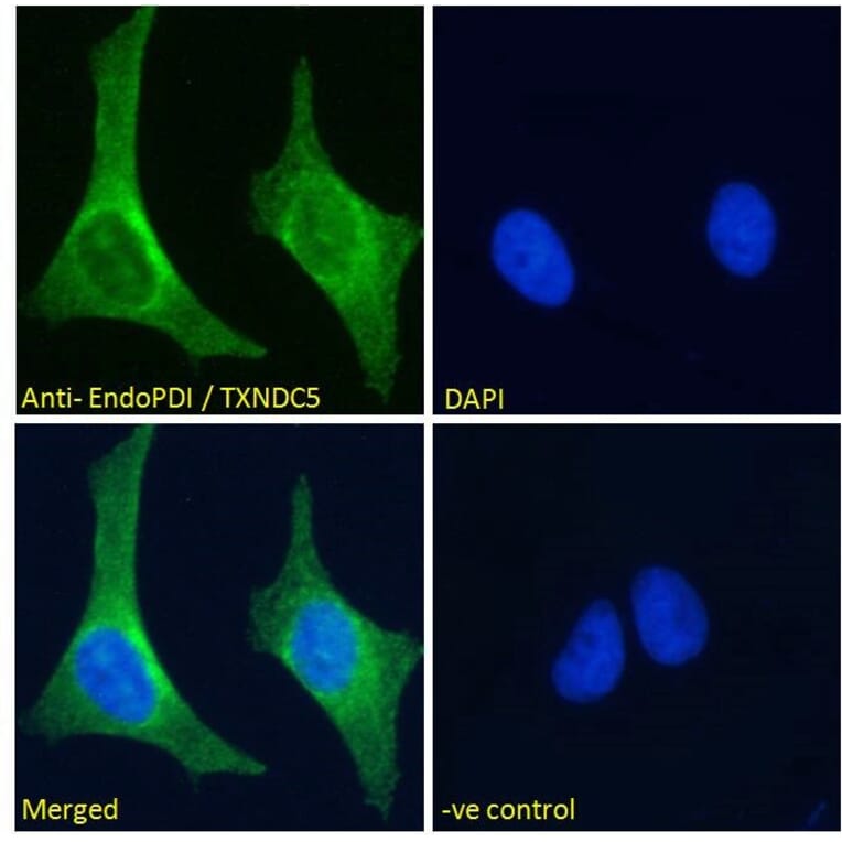 Immunofluorescence - Anti-TXNDC5 Antibody (A83490) - Antibodies.com