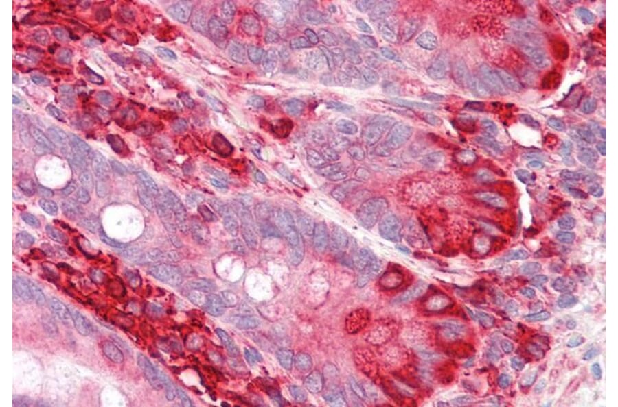 Immunohistochemistry - Anti-TXNDC5 Antibody (A83490) - Antibodies.com