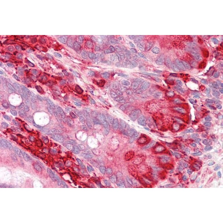 Immunohistochemistry - Anti-TXNDC5 Antibody (A83490) - Antibodies.com
