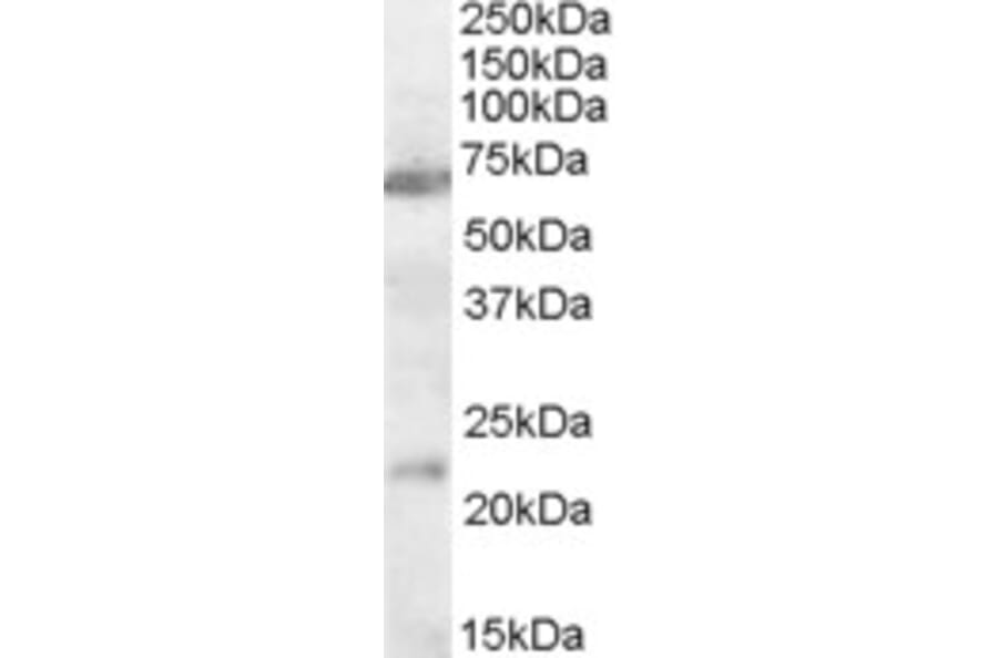 Western Blot - Anti-CHRNA4 Antibody (A83491) - Antibodies.com